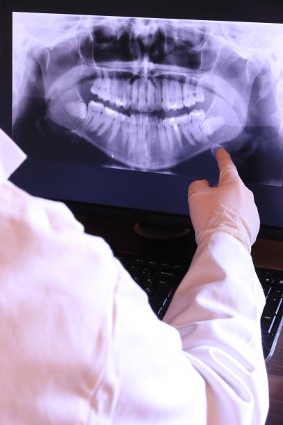 Best Emergency Root Canal Treatment in Fair Oaks Ranch, TX