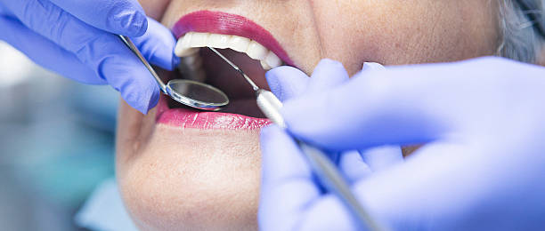 Best Emergency Broken Tooth Repair in Fair Oaks Ranch, TX