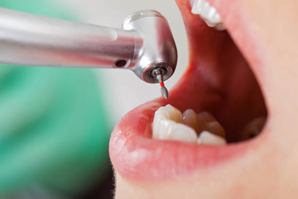 Best Pediatric Emergency Dentist in Fair Oaks Ranch, TX